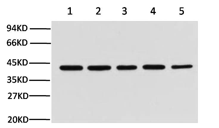 Fig.1. Western blot analysis of hela (1), rat brain (2), Mouse brain (3), chicken lung (4) and rabbit testis (5), diluted at 1:10000.