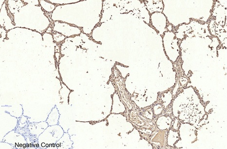 Fig.2. Immunohistochemical analysis of paraffin-embedded human lung tissue. 1, β-actin Monoclonal Antibody (1C7) was diluted at 1:400 (4°C, overnight). Negative control was used by secondary antibody only.