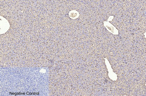 Fig.3. Immunohistochemical analysis of paraffin-embedded Mouse liver tissue. 1, β-actin Monoclonal Antibody (1C7) was diluted at 1:400 (4°C, overnight). Negative control was used by secondary antibody only.