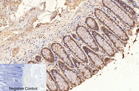 Fig.2. Immunohistochemical analysis of paraffin-embedded human colon tissue. 1, GAPDH Monoclonal Antibody (2B5) was diluted at 1:400 (4°C, overnight). Negative control was used by secondary antibody only.