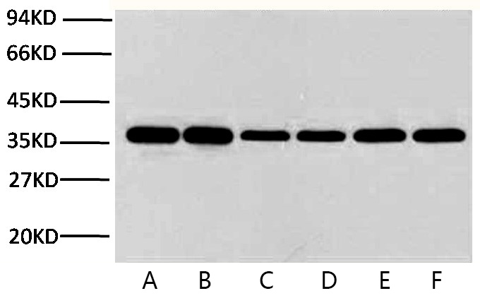 Fig.2. GAPDH表达的WB实验，样本分别为Hela (lane 1）， rat brain (lane 2）， Mouse brain (lane 5）各10 ug，一抗为GAPDH小鼠单克隆抗体(2B5)（A01020，1：10000），二抗为山羊抗小鼠IgG（A21010， 1: 10000）。