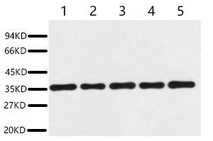 Fig. Western blot analysis of 293T (1), Rat brain (2), NIH 3T3 (3), Sheep Muscle (4), Rabbit testis (5), diluted at 1:20000. Secondary antibody was diluted at 1:20000.