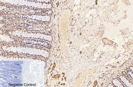Fig.4. Immunohistochemical analysis of paraffin-embedded human colon tissue. 1, β-Tubulin Monoclonal Antibody (3G6) was diluted at 1:400 (4°C, overnight). Negative control was used by secondary antibody only.