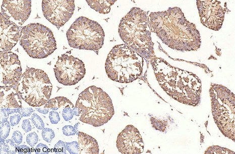 Fig.5. Immunohistochemical analysis of paraffin-embedded mouse testis tissue. 1, β-Tubulin Monoclonal Antibody (3G6) was diluted at 1:400 (4°C, overnight). Negative control was used by secondary antibody only.