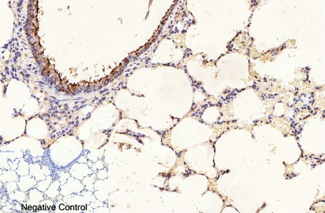 Fig.6. Immunohistochemical analysis of paraffin-embedded rat lung tissue. 1, β-Tubulin Monoclonal Antibody (3G6) was diluted at 1:400 (4°C, overnight). Negative control was used by secondary antibody only.