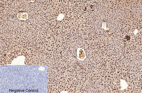 Fig.5. Immunohistochemical analysis of paraffin-embedded mouse liver tissue. 1, PCNA Monoclonal Antibody (1D7) was diluted at 1:200 (4°C, overnight). 2, Sodium citrate pH 6.0 was used for antibody retrieval(>98°C, 20min). 3, secondary antibody was diluted at 1:200 (room temperature, 30min). Negative control was used by secondary antibody only.