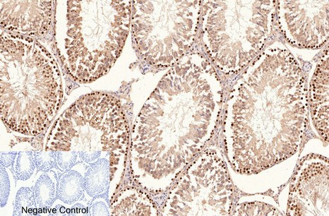 Fig.6. Immunohistochemical analysis of paraffin-embedded rat testis tissue. 1, PCNA Monoclonal Antibod y(1D7) was diluted at 1:200 (4°C, overnight). 2, Sodium citrate pH 6.0 was used for antibody retrieval(>98°C, 20min). 3, secondary antibody was diluted at 1:200 (room temperature, 30min). Negative control was used by secondary antibody only.