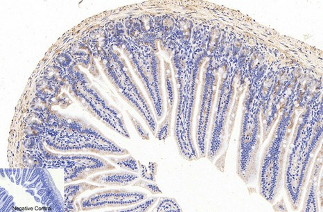 Fig.3. Immunohistochemical analysis of paraffin-embedded mouse colon tissue. 1, COX IV Monoclonal Antibody (14Y2) was diluted at 1:200 (4°C, overnight). 2, Sodium citrate pH 6.0 was used for antibody retrieval (>98°C, 20min). 3, secondary antibody was diluted at 1:200 (room temperature, 30min). Negative control was used by secondary antibody only.