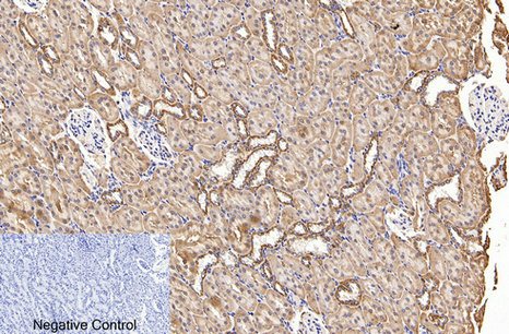 Fig.4. Immunohistochemical analysis of paraffin-embedded rat kidney tissue. 1, COX IV Monoclonal Antibody (14Y2) was diluted at 1:200 (4°C, overnight). 2, Sodium citrate pH 6.0 was used for antibody retrieval (>98°C, 20min). 3, secondary antibody was diluted at 1:200 (room temperature, 30min). Negative control was used by secondary antibody only.