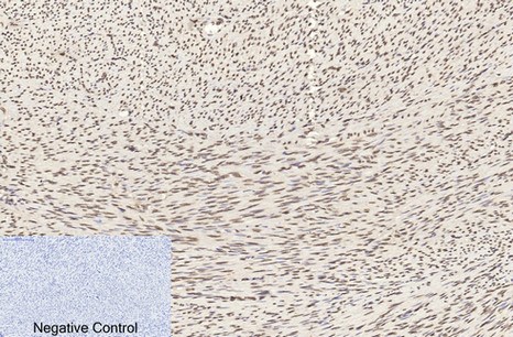 Fig.2. Immunohistochemical analysis of paraffin-embedded human uterus tissue. 1, Histone H3 Monoclonal Antibody (2D10) was diluted at 1:200 (4°C, overnight). 2, Sodium citrate pH 6.0 was used for antibody retrieval (>98°C, 20min). 3, secondary antibody was diluted at 1:200 (room temperature, 30min). Negative control was used by secondary antibody only.