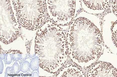 Fig.4. Immunohistochemical analysis of paraffin-embedded rat testis tissue. 1, Histone H3 Monoclonal Antibody (2D10) was diluted at 1:200 (4°C, overnight). 2, Sodium citrate pH 6.0 was used for antibody retrieval (>98°C, 20min). 3, secondary antibody was diluted at 1:200 (room temperature, 30min). Negative control was used by secondary antibody only.