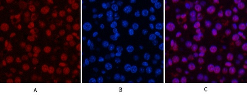 Fig.6. Immunofluorescence analysis of mouse liver tissue. 1, Histone H3 Monoclonal Antibody (2D10) (red) was diluted at 1:200 (4°C, overnight). 2, Cy3 Labeled secondary antibody was diluted at 1:300 (room temperature, 50min). 3, Picture B: DAPI (blue) 10min. Picture A: Target. Picture B: DAPI. Picture C: merge of A+B.
