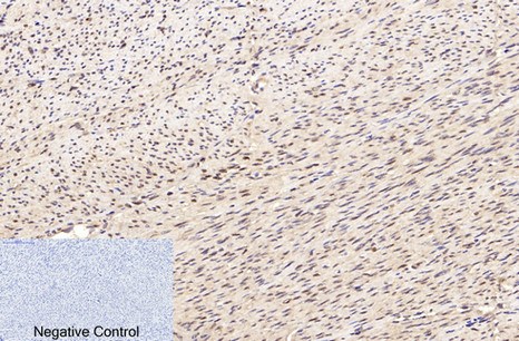 Fig.3. Immunohistochemical analysis of paraffin-embedded human uterus tissue. 1, Lamin B1 Monoclonal Antibody (15T1) was diluted at 1:200 (4°C, overnight). 2, Sodium citrate pH 6.0 was used for antibody retrieval (>98°C, 20min). 3, secondary antibody was diluted at 1:200 (room temperature, 30min). Negative control was used by secondary antibody only.