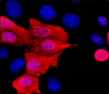 Fig.1. Immunofluorescence staining (1:1500) of His fusion protein in 293 cells with red and counterstained with DAPI.