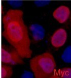 Fig.1. Immunofluorescence staining (1:2000) of Myc fusion protein in 293 cells with red and counterstained with DAPI.