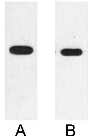 Fig. Western blot analysis of 2ug E2 fusion protein with Anti-E2 monoclonal antibody in 1:2000 (lane A) and 1:5000 (lane B) dilutions.