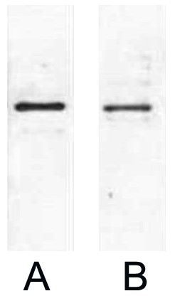 Fig. Western blot analysis of 1ug S-Tag fusion protein with Anti-S Tag monoclonal antibody in 1:2000 (lane A) , 1:5000 (lane B) dilutions.