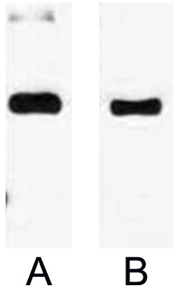 Fig. Western blot analysis of 1ug Trx Tag fusion protein with Anti-Trx Tag monoclonal antibody in 1:3000 (lane A) and 1:5000 (lane B) dilutions.