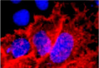 Fig.1. Immunofluorescence staining (1:1000) of V5 tag fusion protein in 293 cells with red and counterstained with DAPI.
