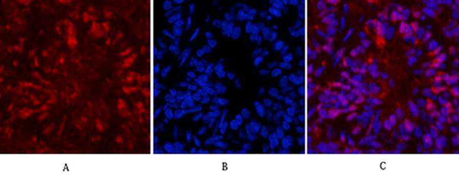 Fig.6. Immunofluorescence analysis of mouse lung tissue. 1, HSP70 Monoclonal Antibody (red) was diluted at 1:200 (4°C, overnight). 2, Cy3 Labeled secondary antibody was diluted at 1:300 (room temperature, 50min). 3, Picture B: DAPI (blue) 10min. Picture A: Target. Picture B: DAPI. Picture C: merge of A+B.