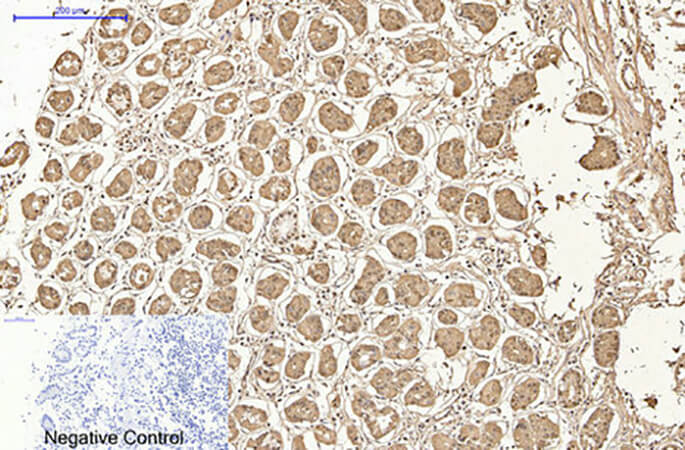 Fig.2. Immunohistochemical analysis of paraffin-embedded human stomach tissue. 1, AMACR Monoclonal Antibody was diluted at 1:200 (4°C, overnight). 2, Sodium citrate pH 6.0 was used for antibody retrieval (>98°C, 20min). 3, secondary antibody was diluted at 1:200 (room temperature, 30min). Negative control was used by secondary antibody only.