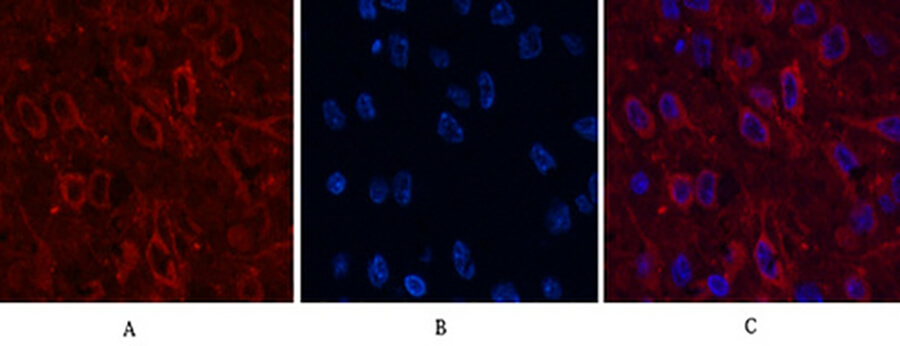 Fig.6. Immunofluorescence analysis of rat brain tissue. 1, AMACR Monoclonal Antibody)  (red) was diluted at 1:200 (4°C, overnight). 2, Cy3 Labeled secondary antibody was diluted at 1:300 (room temperature, 50min). 3, Picture B: DAPI (blue) 10min. Picture A: Target. Picture B: DAPI. Picture C: merge of A+B.