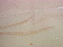 Fig.2. IHC-P staining of Mouse hippocampus tissue, diluted at 1:200.