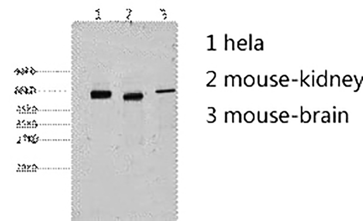 Fig.2. Western blot analysis of 1) Hela, 2) mouse kidney, 3) mouse brain, diluted at 1:2000.