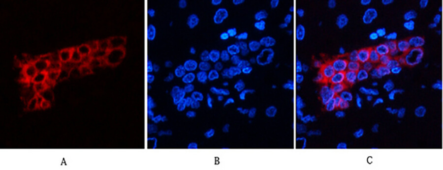 Fig.3. Immunofluorescence analysis of human liver tissue. 1, CK7 Monoclonal Antibody (red) was diluted at 1:200 (4°C, overnight). 2, Cy3 Labeled secondary antibody was diluted at 1:300 (room temperature, 50min). 3, Picture B: DAPI (blue) 10min. Picture A: Target. Picture B: DAPI. Picture C: merge of A+B.