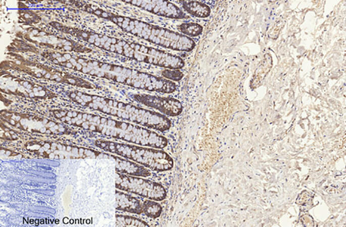 Fig.2. Immunohistochemical analysis of paraffin-embedded human colon tissue. 1, CK8 Monoclonal Antibody was diluted at 1:200 (4°C, overnight). 2, Sodium citrate pH 6.0 was used for antibody retrieval (>98°C, 20min). 3, secondary antibody was diluted at 1:200 (room temperature, 30min). Negative control was used by secondary antibody only.