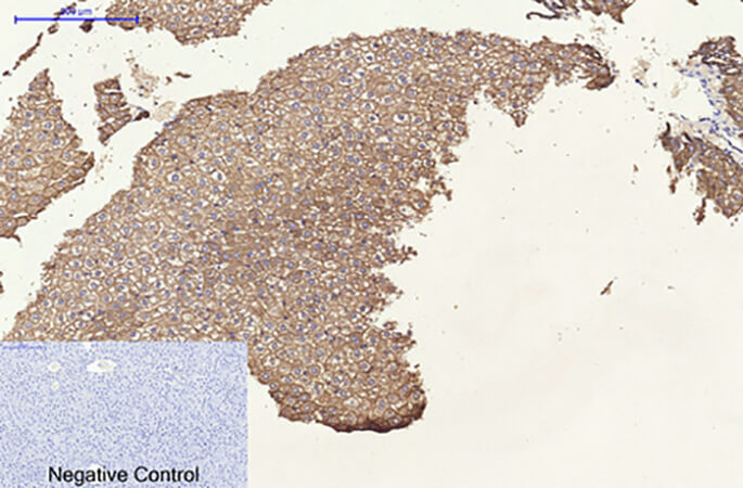 Fig.4. Immunohistochemical analysis of paraffin-embedded rat liver tissue. 1, CK8 Monoclonal Antibody was diluted at 1:200 (4°C, overnight). 2, Sodium citrate pH 6.0 was used for antibody retrieval (>98°C, 20min). 3, secondary antibody was diluted at 1:200 (room temperature, 30min). Negative control was used by secondary antibody only.