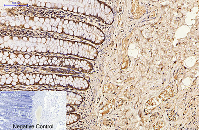 Fig.2. Immunohistochemical analysis of paraffin-embedded human colon tissue. 1, CDX2 Monoclonal Antibody was diluted at 1:200 (4°C, overnight). 2, Sodium citrate pH 6.0 was used for antibody retrieval (>98°C, 20min). 3, secondary antibody was diluted at 1:200 (room temperature, 30min). Negative control was used by secondary antibody only.