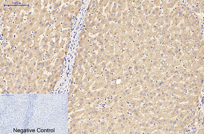 Fig.2. Immunohistochemical analysis of paraffin-embedded human liver tissue. 1, GFAP Monoclonal Antibody was diluted at 1:200 (4°C, overnight). 2, Sodium citrate pH 6.0 was used for antibody retrieval (>98°C, 20min). 3, secondary antibody was diluted at 1:200 (room temperature, 30min). Negative control was used by secondary antibody only.
