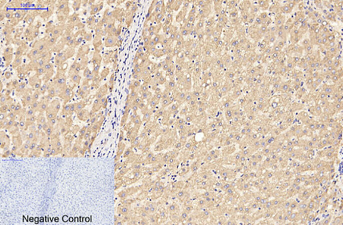 Fig.2. Immunohistochemical analysis of paraffin-embedded human liver tissue. 1, GFAP Monoclonal Antibody was diluted at 1:200 (4°C, overnight). 2, Sodium citrate pH 6.0 was used for antibody retrieval (>98°C, 20min). 3, secondary antibody was diluted at 1:200 (room temperature, 30min). Negative control was used by secondary antibody only.