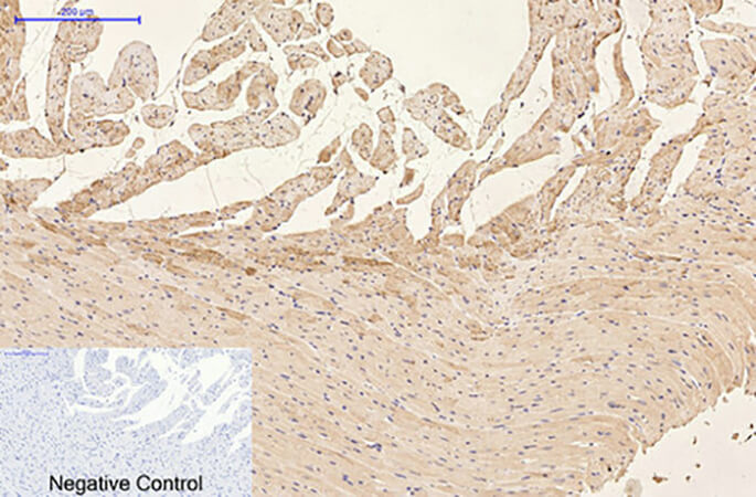 Fig.4. Immunohistochemical analysis of paraffin-embedded rat heart tissue. 1, GFAP Monoclonal Antibody was diluted at 1:200 (4°C, overnight). 2, Sodium citrate pH 6.0 was used for antibody retrieval (>98°C, 20min). 3, secondary antibody was diluted at 1:200 (room temperature, 30min). Negative control was used by secondary antibody only.