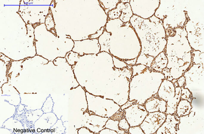 Fig.2. Immunohistochemical analysis of paraffin-embedded human lung tissue. 1, Caspase 9 Monoclonal Antibody was diluted at 1:200 (4°C, overnight). 2, Sodium citrate pH 6.0 was used for antibody retrieval (>98°C, 20min). 3, secondary antibody was diluted at 1:200 (room temperature, 30min). Negative control was used by secondary antibody only.