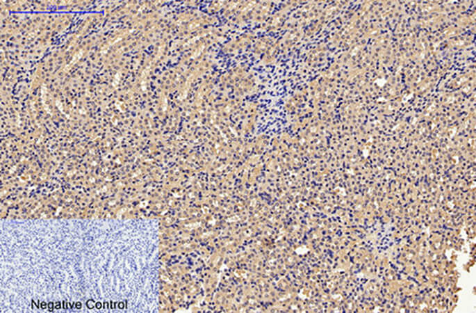 Fig.3. Immunohistochemical analysis of paraffin-embedded mouse kidney tissue. 1, Caspase 9 Monoclonal Antibody was diluted at 1:200 (4°C, overnight). 2, Sodium citrate pH 6.0 was used for antibody retrieval (>98°C, 20min). 3, secondary antibody was diluted at 1:200 (room temperature, 30min). Negative control was used by secondary antibody only.