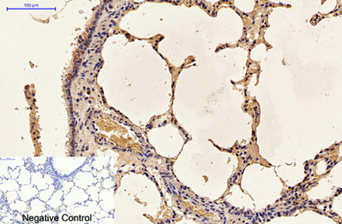 Fig.4. Immunohistochemical analysis of paraffin-embedded rat lung tissue. 1, Caspase 9 Monoclonal Antibody was diluted at 1:200 (4°C, overnight). 2, Sodium citrate pH 6.0 was used for antibody retrieval (>98°C, 20min). 3, secondary antibody was diluted at 1:200 (room temperature, 30min). Negative control was used by secondary antibody only.