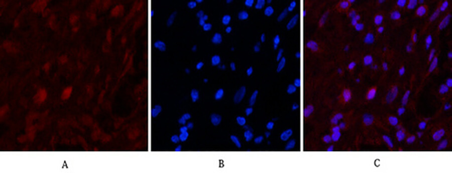 Fig.5. Immunofluorescence analysis of human appendix tissue. 1, Caspase 9 Monoclonal Antibody (red) was diluted at 1:200 (4°C, overnight). 2, Cy3 Labeled secondary antibody was diluted at 1:300 (room temperature, 50min). 3, Picture B: DAPI (blue) 10min. Picture A: Target. Picture B: DAPI. Picture C: merge of A+B.