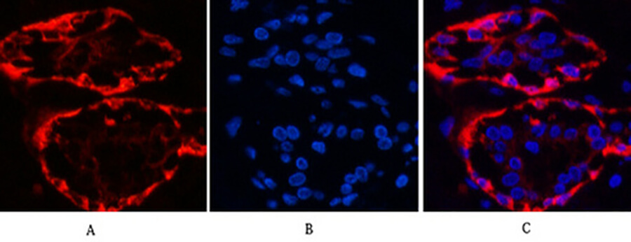 Fig.3. Immunofluorescence analysis of human breast tissue. 1, CK17 Monoclonal Antibody (red) was diluted at 1:200 (4°C, overnight). 2, Cy3 Labeled secondary antibody was diluted at 1:300 (room temperature, 50min). 3, Picture B: DAPI (blue) 10min. Picture A: Target. Picture B: DAPI. Picture C: merge of A+B.