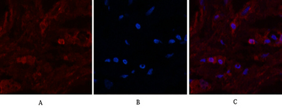 Fig.3. Immunofluorescence analysis of human breast tissue. 1, alpha Lactalbumin Monoclonal Antibody (red) was diluted at 1:200 (4°C, overnight). 2, Cy3 Labeled secondary antibody was diluted at 1:300 (room temperature, 50min). 3, Picture B: DAPI (blue) 10min. Picture A: Target. Picture B: DAPI. Picture C: merge of A+B.