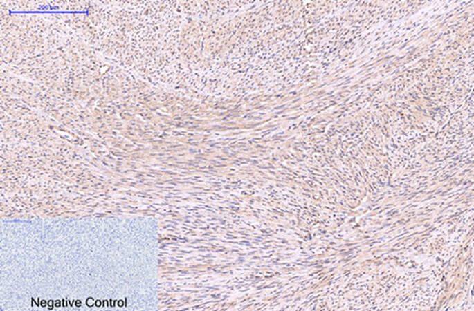Fig.2. Immunohistochemical analysis of paraffin-embedded human uterus tissue. 1, EFHD1 Monoclonal Antibody was diluted at 1:200 (4°C, overnight). 2, Sodium citrate pH 6.0 was used for antibody retrieval (>98°C, 20min). 3, secondary antibody was diluted at 1:200 (room temperature, 30min). Negative control was used by secondary antibody only.