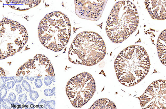 Fig.3. Immunohistochemical analysis of paraffin-embedded mouse testis tissue. 1, EFHD1 Monoclonal Antibody was diluted at 1:200 (4°C, overnight). 2, Sodium citrate pH 6.0 was used for antibody retrieval (>98°C, 20min). 3, secondary antibody was diluted at 1:200 (room temperature, 30min). Negative control was used by secondary antibody only.