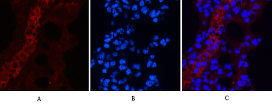 Fig.5. Immunofluorescence analysis of mouse lung tissue. 1, EFHD1 Monoclonal Antibody (red) was diluted at 1:200 (4°C, overnight). 2, Cy3 Labeled secondary antibody was diluted at 1:300 (room temperature, 50min). 3, Picture B: DAPI (blue) 10min. Picture A: Target. Picture B: DAPI. Picture C: merge of A+B.