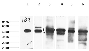 Fig.1. Western blot analysis of 1) HepG2, 2) Hela, 3) Mouse Liver tissue, 4) C2C12, 5) Rat Heart tissue, 6) Mouse Skeletal Muscle tissue, diluted at 1:2000.