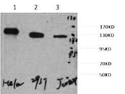 Fig. Western blot analysis of 1) Hela, 2) 293T, 3) Jurkat, diluted at 1:2000.