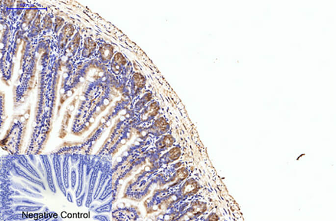Fig.3. Immunohistochemical analysis of paraffin-embedded mouse colon tissue. 1, eIF4A1 Monoclonal Antibody was diluted at 1:200 (4°C, overnight). 2, Sodium citrate pH 6.0 was used for antibody retrieval (>98°C, 20min). 3, secondary antibody was diluted at 1:200 (room temperature, 30min). Negative control was used by secondary antibody only.