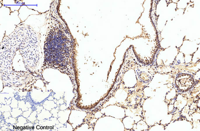 Fig.4. Immunohistochemical analysis of paraffin-embedded rat lung tissue. 1, eIF4A1 Monoclonal Antibody was diluted at 1:200 (4°C, overnight). 2, Sodium citrate pH 6.0 was used for antibody retrieval (>98°C, 20min). 3, secondary antibody was diluted at 1:200 (room temperature, 30min). Negative control was used by secondary antibody only.