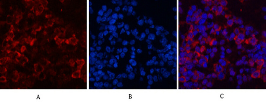 Fig.5. Immunofluorescence analysis of mouse spleen tissue. 1, eIF4A1 Monoclonal Antibody (red) was diluted at 1:200 (4°C, overnight). 2, Cy3 Labeled secondary antibody was diluted at 1:300 (room temperature, 50min). 3, Picture B: DAPI (blue) 10min. Picture A: Target. Picture B: DAPI. Picture C: merge of A+B.