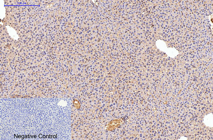 Fig.2. Immunohistochemical analysis of paraffin-embedded mouse liver tissue. 1, Fibronectin Monoclonal Antibody was diluted at 1:200 (4°C, overnight). 2, Sodium citrate pH 6.0 was used for antibody retrieval (>98°C, 20min). 3, secondary antibody was diluted at 1:200 (room temperature, 30min). Negative control was used by secondary antibody only.